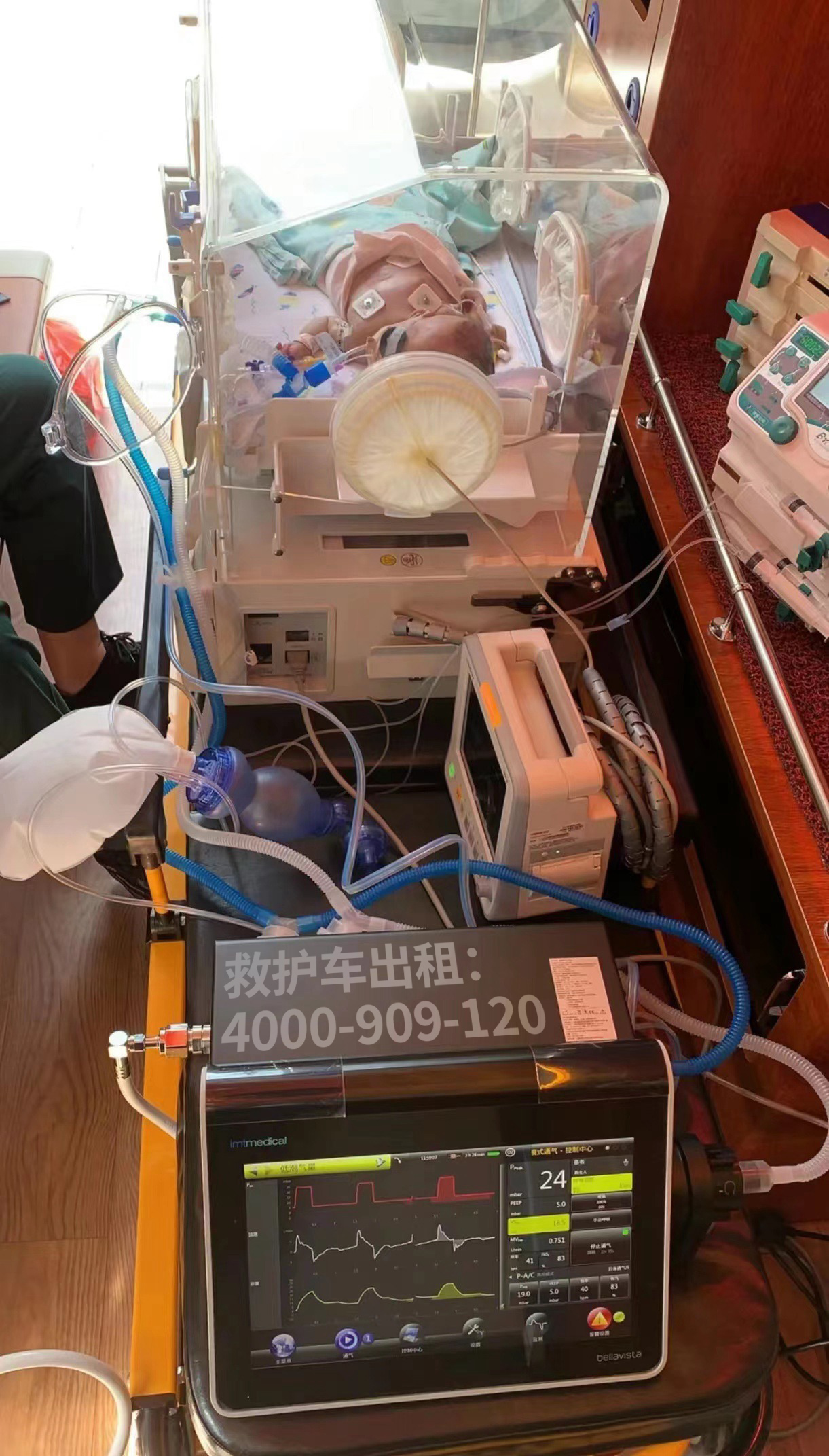 怎样选取重症icu救护车租赁急救中心重庆北碚区？服务范围要首先考虑